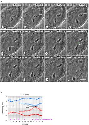 Blocking Protein Phosphatase 1 [PP1] Prevents Loss of Tether Elasticity in Anaphase Crane-Fly Spermatocytes